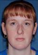 rhinoplasty-germantown